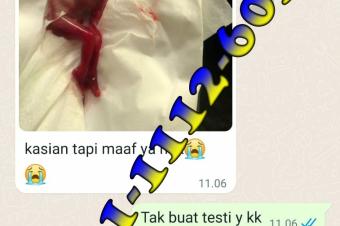 Jual Cytotec Via Shopee Surabaya 082111126033 Obat Cytotec COD Via Shopee